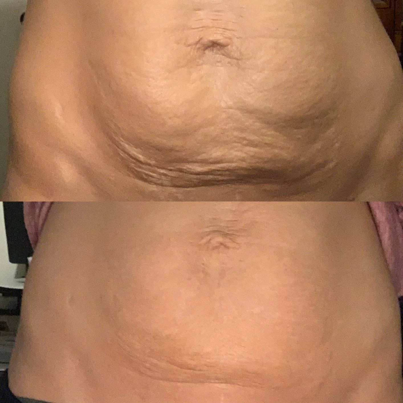 Norena™ Body Toning Elixir