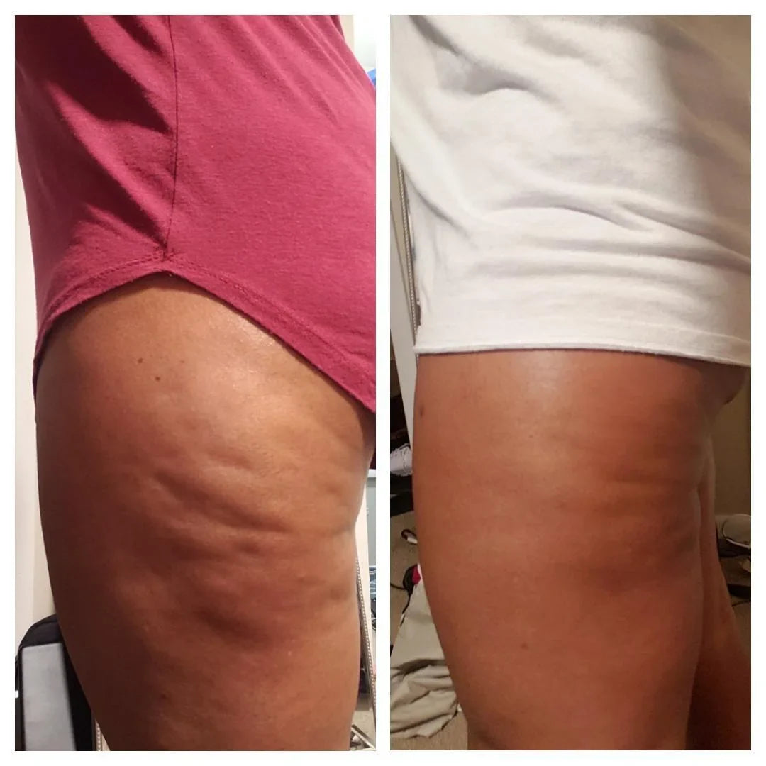 Norena™ Body Toning Elixir